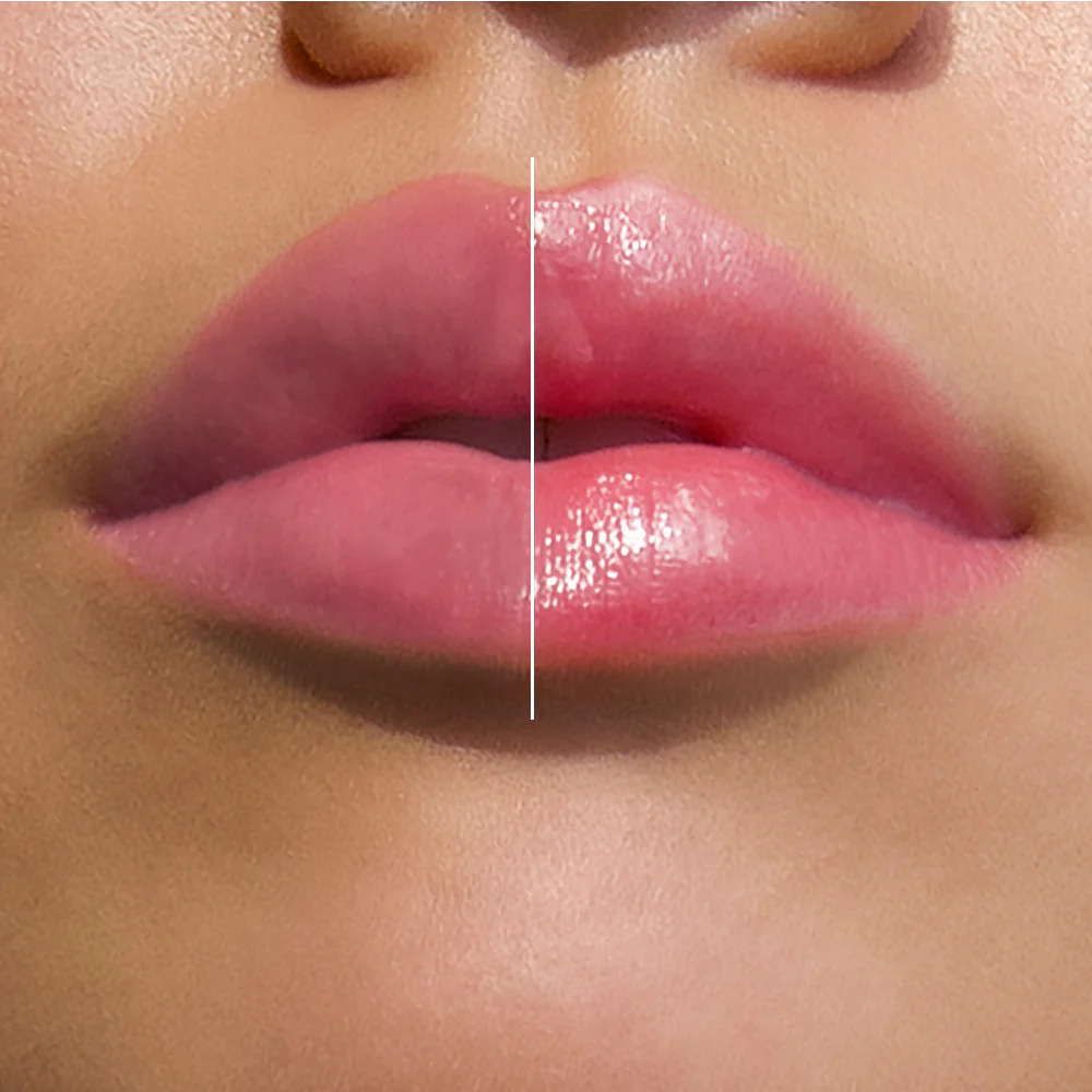 Uniquely You — Lip 1